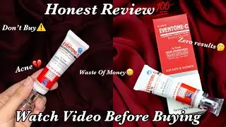THE REALITY OF EVENTONE-C Cream||Honest & Non Sponsored Review