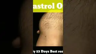 #Beardgrowth | Grow your beard from Castrol oil in 23 days for best results