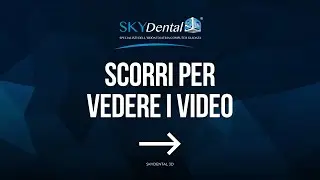 Implantologia Computer Guidata in breve
