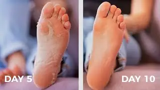 #1 Amazon Finds TikTok - The Best Foot Peeling Mask Plantifique Skincare