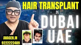 Hair Transplant In Dubai | Best Hair Transplant Clinic