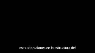 Prolapso y regurgitaci&oacute;n de la v&aacute;lvula mitral, #p&oacute;dcast