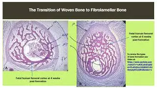 Osteogenesis 3   Development of a Long Bone