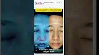 From Consultation to Confidence | AI Skin Analyzer for Professional Clinics