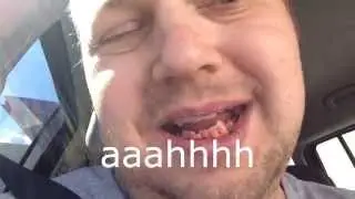 Blastminerdad's Wisdom Tooth Adventure