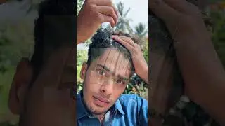 PROSKIRE Intense hair Growth serum #proskire #viral #yt #ytshorts #hair #hairgrowth #trending