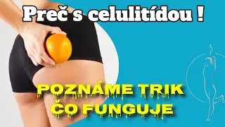 Celulitída preč s ňou ! Poznáme trik, čo funguje - Cvičíme pre ZDRAVIE #10 👌 | Zora Czoborová