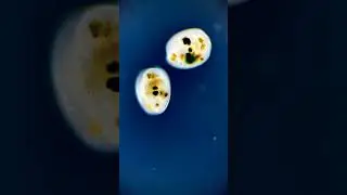 💯 division of the ciliate/Ciliophora into two cells 😱 respect #shorts