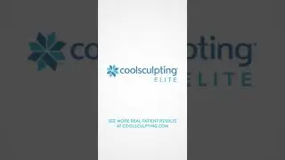 🌟 Get Your Dream Shape with Coolsculpting at Bella MedSpa &ndash; Book Now! 🌟