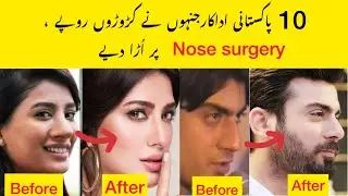 Pakistani Actors who had Nose surgery to look beautiful