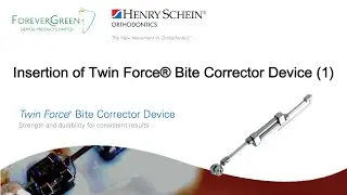 Insertion of Twin Force&reg; Bite Corrector Device (1)