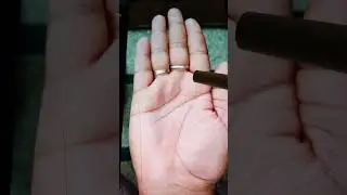 Right palm analysis: Square hand, active mount, passive, bifurcated life line, future health scaring