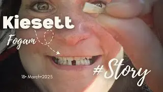 Kiesett fogam #storytime