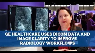 Компания GE Healthcare использует данные и четкость изображений в формате DICOM для улучшения раб...