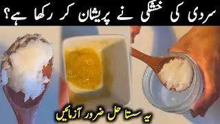 Best Home Remedy for Dry Skin in Winter | Easy & Affordable