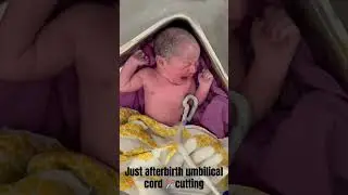 Rart / #how to cut umbilical cord #shortsvideo #short #youtubeshort...