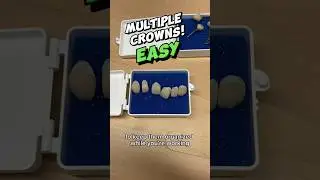 don&rsquo;t cement the Wrong crown onto the Wrong tooth
