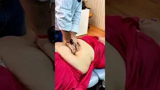 navel displacement treatment #ytshort #feedshort #trend