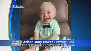 TRENDING - 2018 Gerber Baby, Lucas, Is First Gerber Baby With Down Syndrome