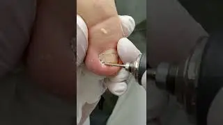 Professional foot care at Linel