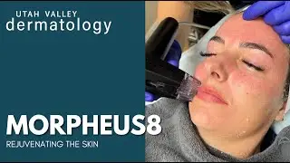 Morpheus8 | Utah Valley Dermatology