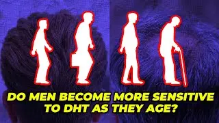 Do Men Become More Sensitive To DHT As They Age?