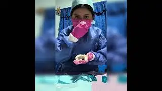 Toma de impresiones en alginato y vaciado de la impresi&oacute;n en yeso 