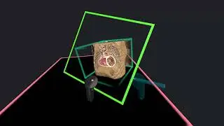 4D ECHO CT Fusion for VR Surgical Planning