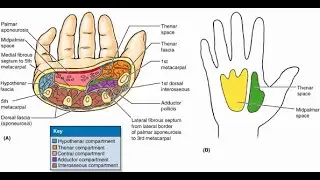 Spaces of the palm Hand; Pulp spaces of fingers, hypothenar, Thenar and mid palmar spaces