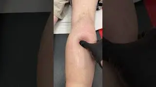 DEEP TISSUE MASSAGE CALF PAIN