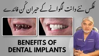 Missing teeth? Dental Implants can bring your smile back to li fe!by Prof.Dr.Zahid Iqbal