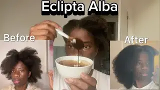 How Eclipta Alba Helped Me Grow My Natural Hair in 10 Months | 4C Hair Growth Journey 