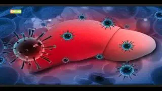 Health ministry issues alert following Hepatitis A outbreak in Mombasa