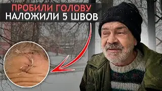 КТО  ИЗБИЛ СЕРГЕЯ? МЫ УЗНАЛИ ПРАВДУ.  г.Орел