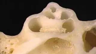 Acland's Video Atlas of Human Anatomy: Cochlea