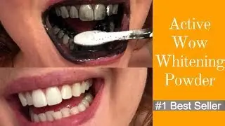 THE TRUTH about Active Wow Teeth Whitening Charcoal Powder :O