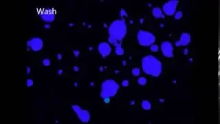 TRPM8 is a neuronal osmosensor that regulates eye blinking in mice