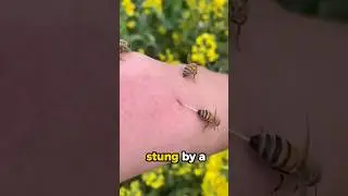 If a bee stings you, don't do this 🐝🚑😮