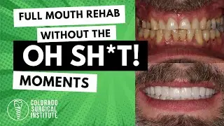 Dental Success Network with Mark Costes Webinar: Full Mouth Rehab Without the Oh Sh*t! Moments