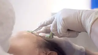 Accutite: minimal invasive fat reduction and tightening