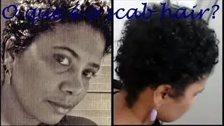 DESCUBRA O QUE &Eacute; SCAB HAIR