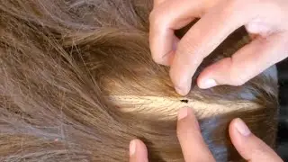 ASMR - I Tried a Scalp Treatment for Anxiety & Insomnia✨✨