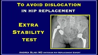 Extra stability test in hip replacement