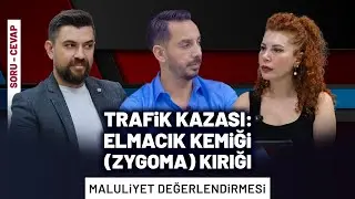 🔥 Trafik Kazası Sonucu ELMACIK KEMİĞİ (ZİGOMATİK) KIRIKLARI! Yüz ÇÖKTÜ, Dosya KAPANDI MI?