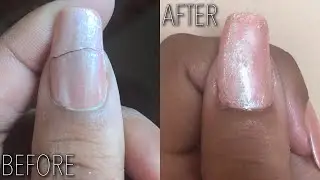 How to Fix Your Broken Natural Nail