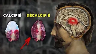 J'ai enfin r&eacute;ussi &agrave; d&eacute;calcifier ma glande pin&eacute;ale (voici comment)