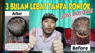 PARAH SIH!! PAKAI BIG6 MINOXIDIL NUMBUHIN RAMBUT 3 BULANG AUTO LEBAT & PASTINYA NGGA RONTOK LAGI!!