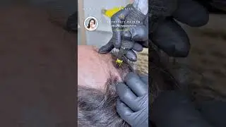 Aesthetics Health scalp micropigmentation the best solution for your hair loss #beauty #eyebrow