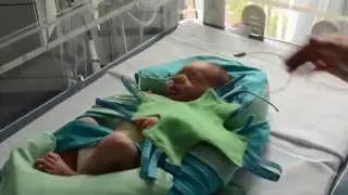 10 essential tips on positioning preemies