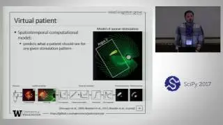 pulse2percept - A Python based Simulation Framework for Bionic Vision | SciPy 2017 | Michael Beyeler